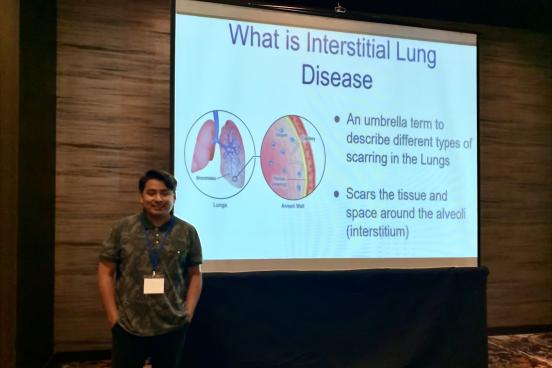 Student in front of a presentation screen titled "What is Interstitial Lung Disease?"